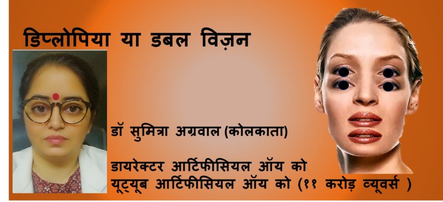 डिप्लोपिया या डबल विज़न जानते है डॉ सुमित्रा से