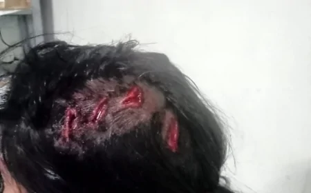 नौकरी दिलाने का झांसा देकर बेनीगंज मे महिला को बुलाया, फिर मारपीट कर दिया घायल