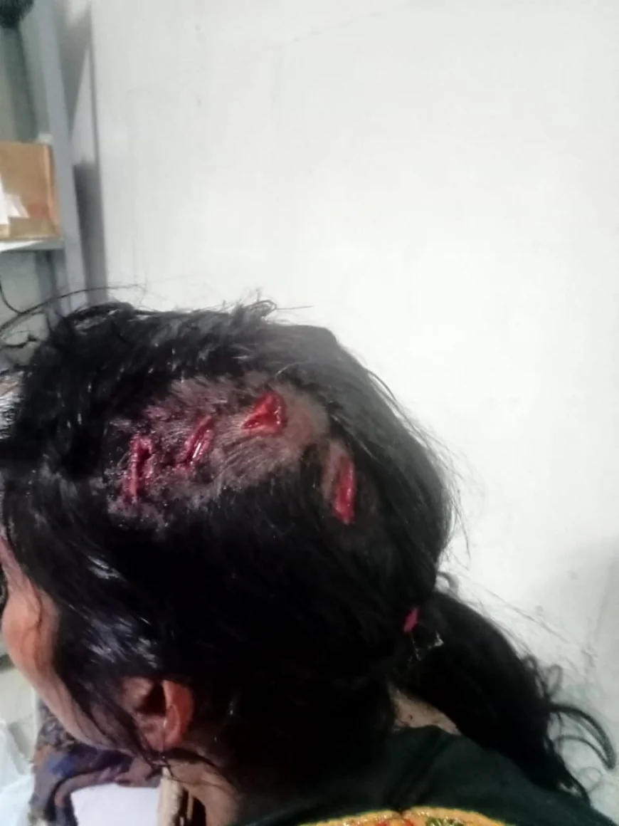 नौकरी दिलाने का झांसा देकर बेनीगंज मे महिला को बुलाया, फिर मारपीट कर दिया घायल