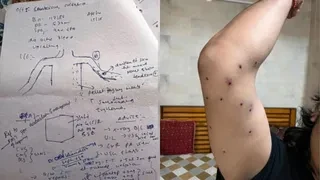 प्रदर्शनकारियों पर पैलेट गन चलाने वाले RAF जवान की पहचान, CRPF जांच अंतिम चरण में