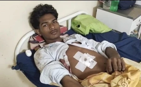 थाने से लौटते ही दो भाइयों पर जानलेवा चाकू हमला, पुरानी रंजिश में घेरकर किया लहूलुहान
