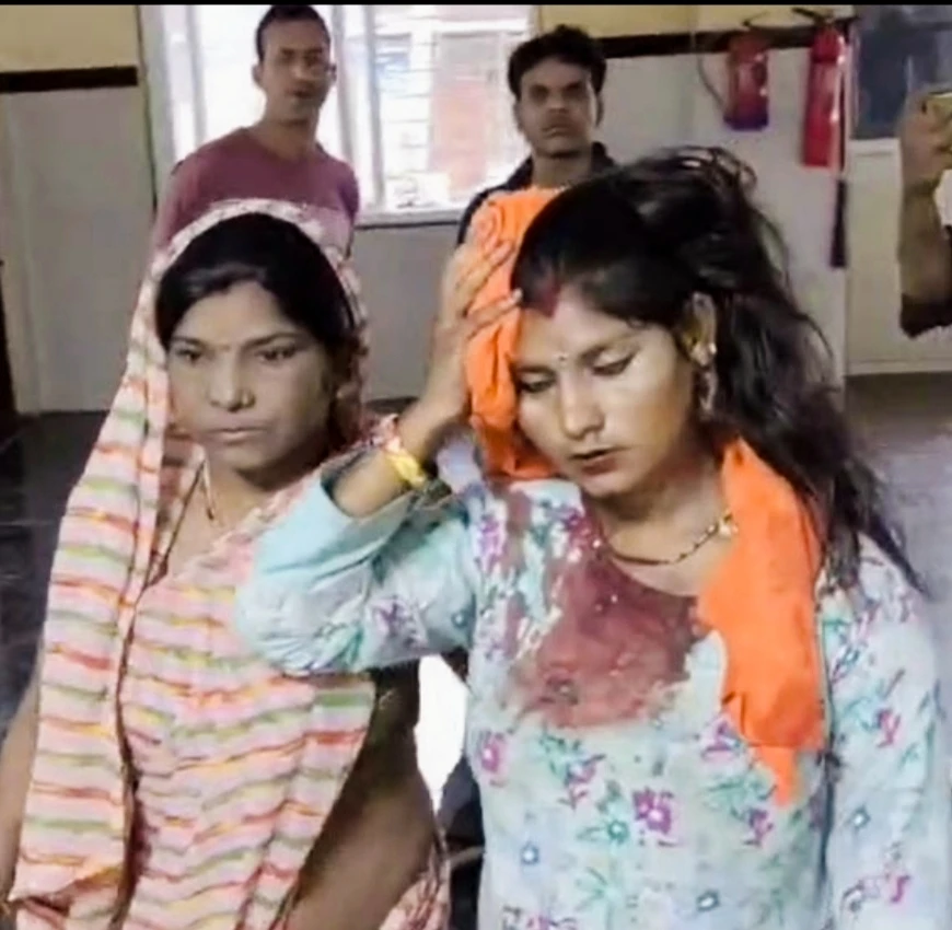 गुना में छेड़छाड़ के आरोप पर खूनी संघर्ष, सपेरा बस्ती में दो पक्ष भिड़े; महिला समेत 4 घायल