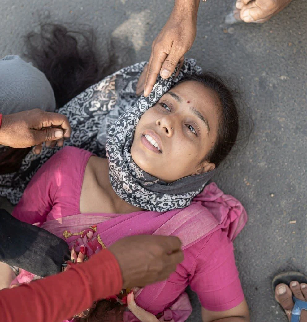 कैलारस में गलतफहमी में दिया गया CPR, शिक्षिका की दो पसलियां टूटीं