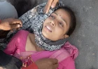 कैलारस में गलतफहमी में दिया गया CPR, शिक्षिका की दो पसलियां टूटीं