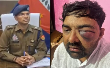 मेरठ: थप्पड़ कांड के बाद फिर विवादों में SSP, सपा नेता ने लगाए मारपीट के आरोप; अखिलेश ने मांगी जांच