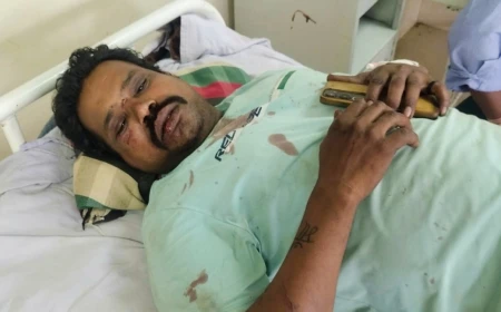 नानाखेड़ी से लौट रहे ऑटो को बस ने मारी टक्कर, चालक गंभीर रूप से घायल